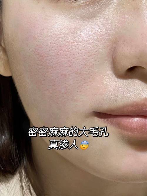 Wichuda医生技术优势: