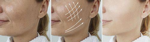 成都武侯艾凡加整形医院地址电话及营业时间