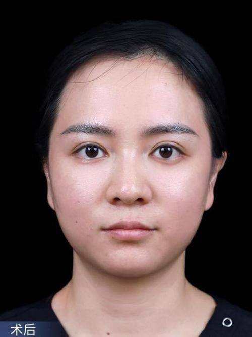 宁波韩美医疗美容门诊部怎么样?