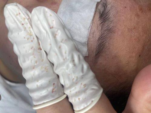 南京大麦医疗美容门诊部医生名单及擅长领域