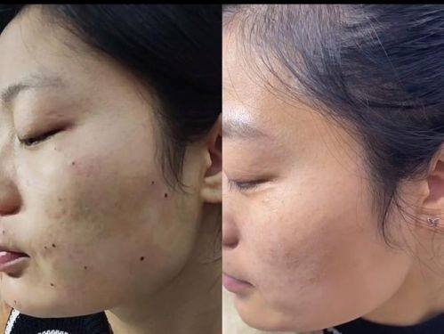 韩国JUAN珠颜皮肤科怎么样?