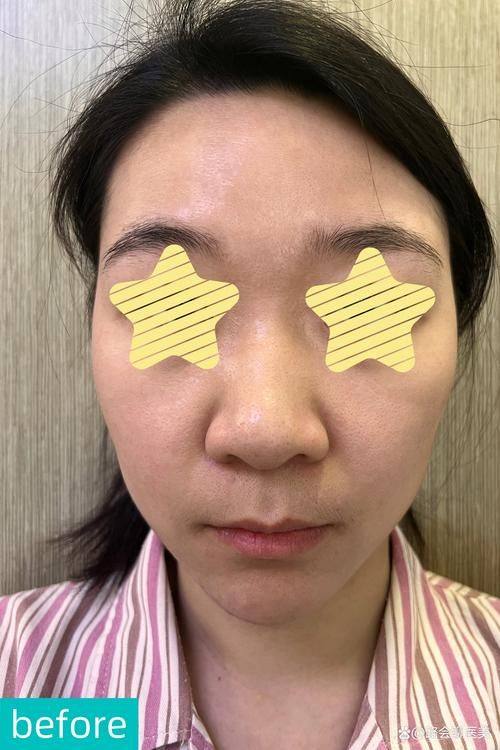 白永明医生口碑评价