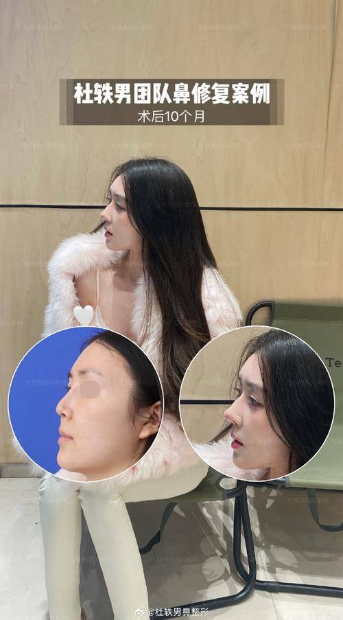 北京美颐天整形医院口碑评价