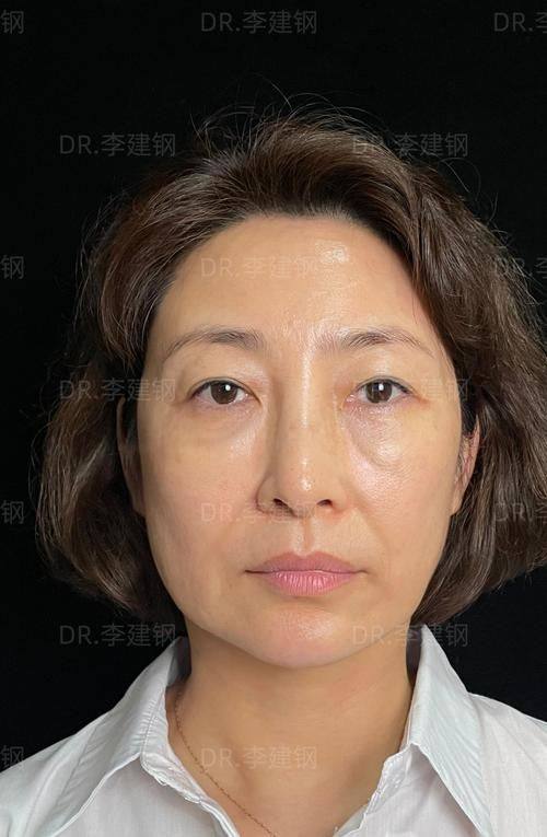 荆门华美仁爱整形美容预约挂号方式: