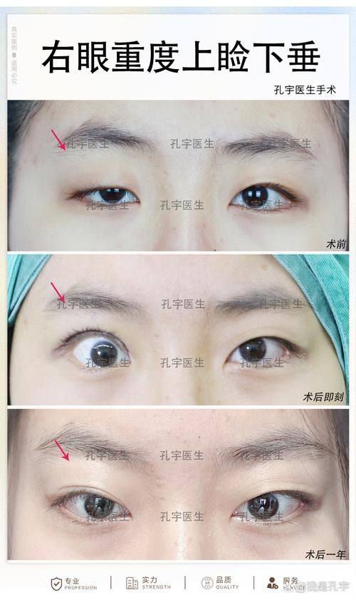 成都武侯艾凡加整形医院擅长项目：