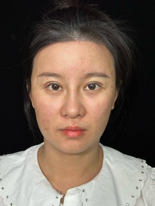 山东临沂郯城新益民医院价格表