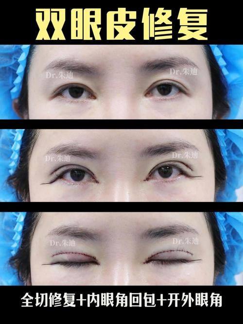 山东临沂郯城新益民医院预约挂号方式