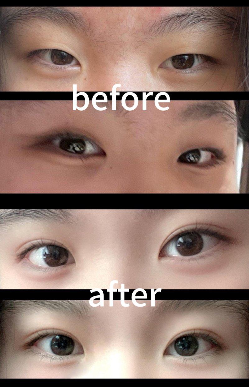 吴大毛医生怎么预约