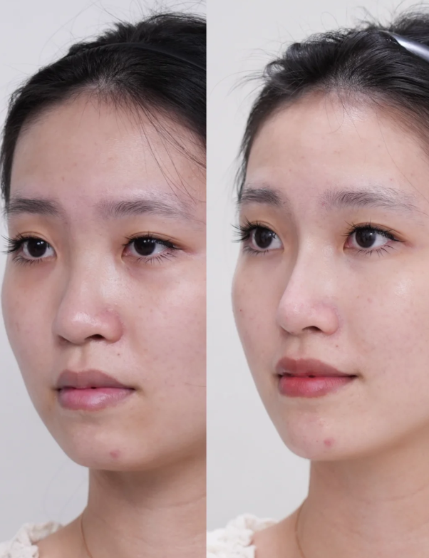 黄冈浠水海沁整形诊所预约挂号方式：