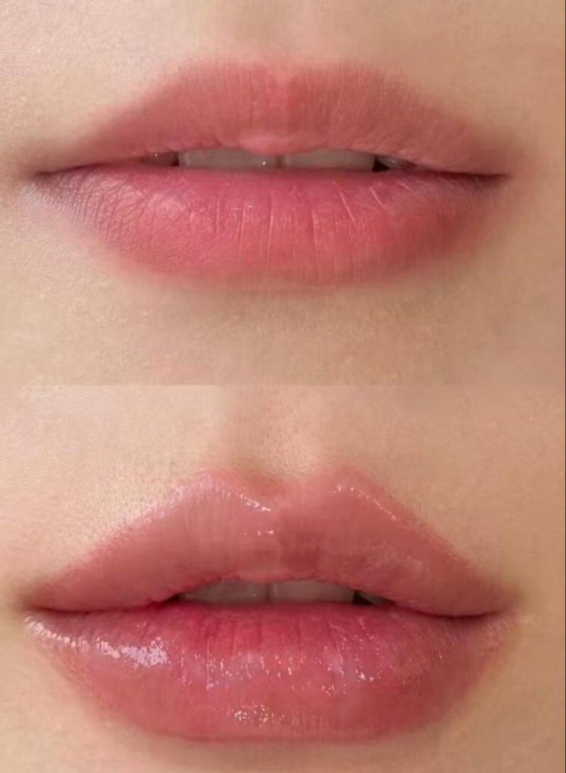 郑州健丽医疗美容诊所擅长项目: