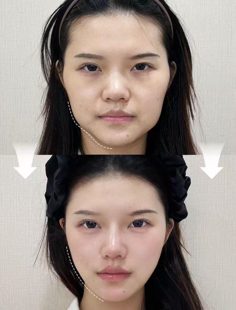 黄冈浠水海沁整形诊所医生名单及擅长领域：