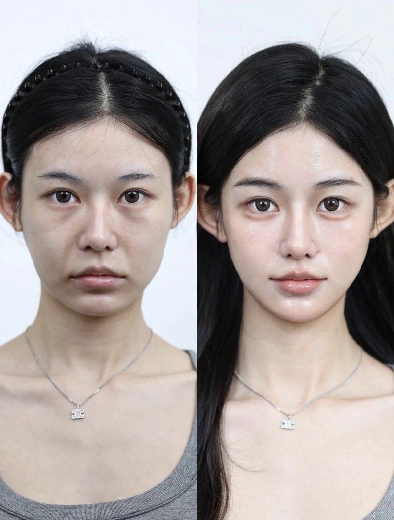 六、祛疤关键注意事项：从术前到术后的全流程把控