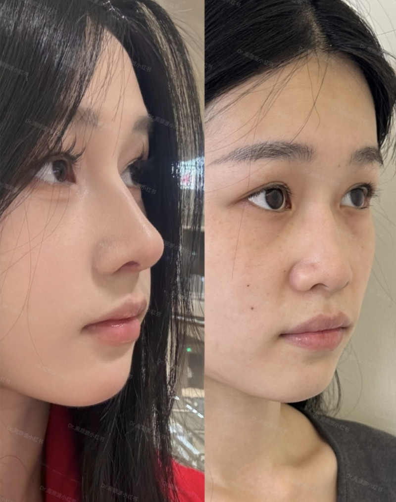 五、不同部位的修复周期，决定运动节奏的核心