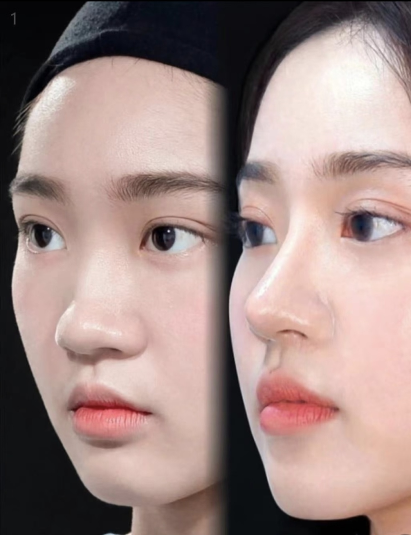 Santiphap医生怎么预约