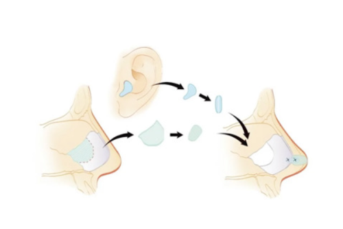 临沂卫康中医医院医疗美容科怎么样？
