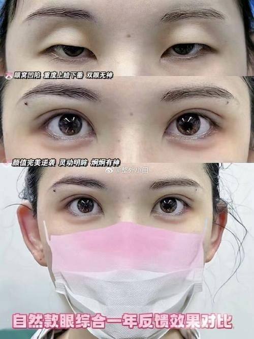 东莞菀城圣之慧医疗美容门诊部预约挂号方式