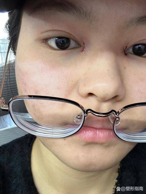 东莞菀城圣之慧医疗美容门诊部价格表