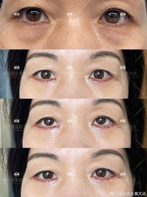 兴化艾尚美医疗美容医院口碑评价