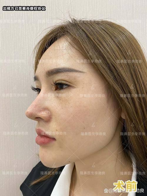 东莞菀城圣之慧医疗美容门诊部擅长项目