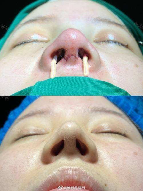 东莞菀城圣之慧医疗美容门诊部口碑评价