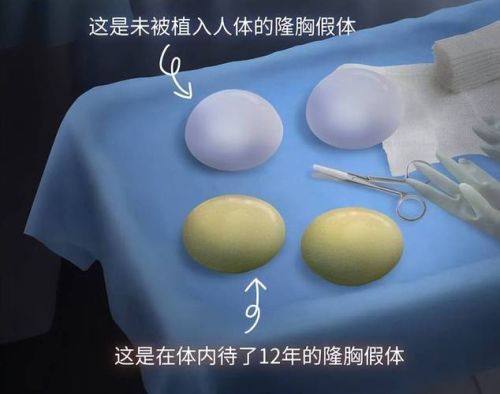 临沂卫康中医医院医疗美容科擅长项目：