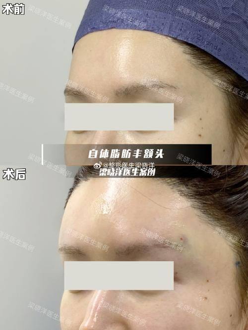 沈阳童颜医疗美容门诊部擅长项目: