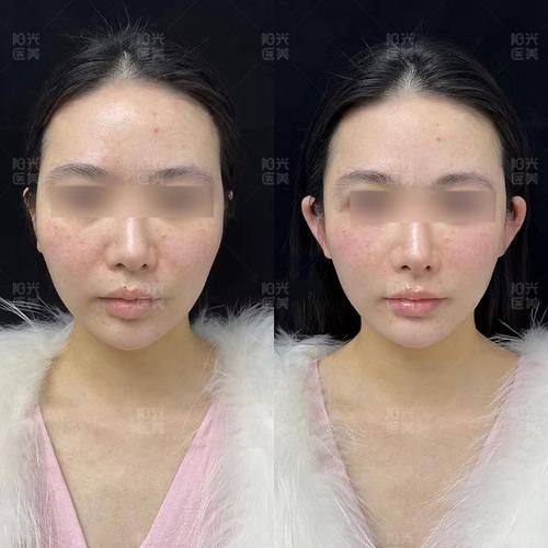 沈阳童颜医疗美容门诊部预约挂号方式: