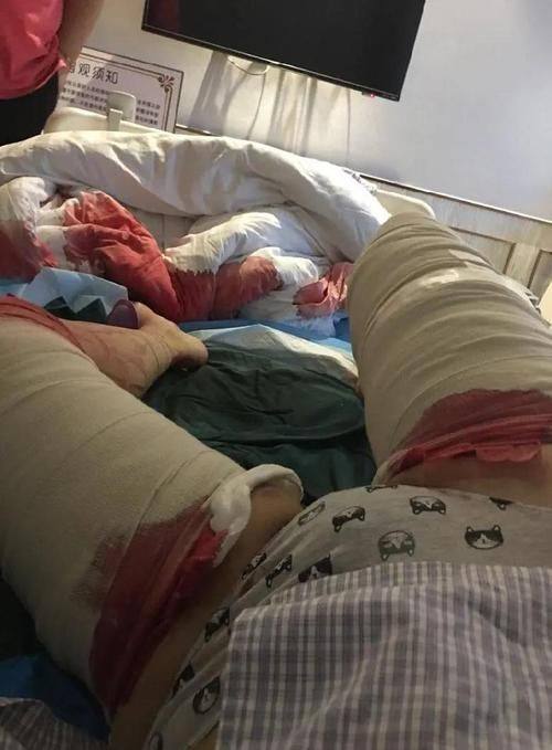 济南蓝白整形医院怎么样