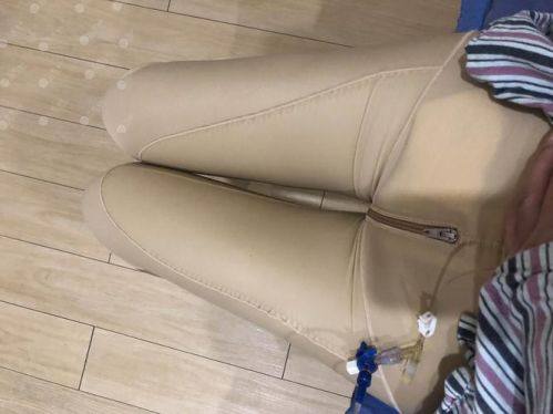 Wichuda医生技术优势