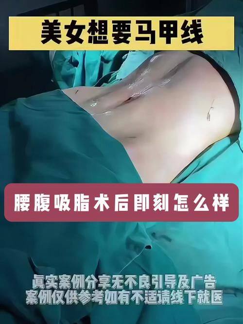 兴化艾尚美医疗美容医院怎么样？