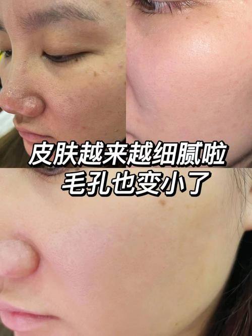 邓飞艳医生擅长领域