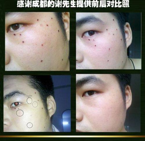 临沂卫康中医医院医疗美容科地址电话及营业时间：