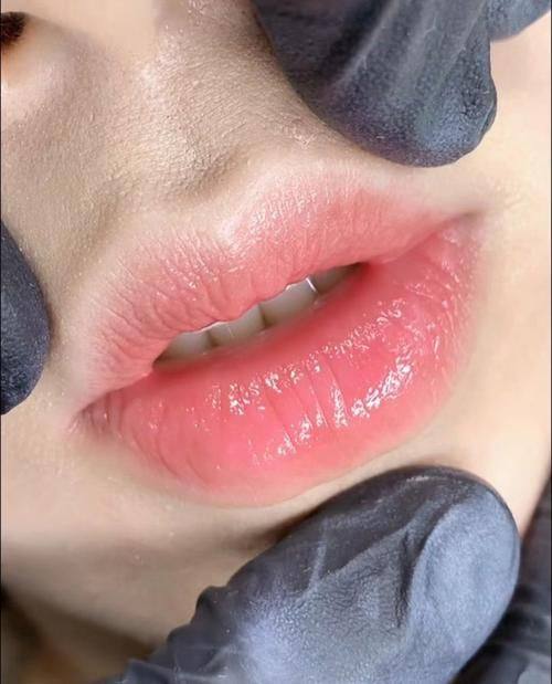 临沂卫康中医医院医疗美容科医生名单及擅长领域：