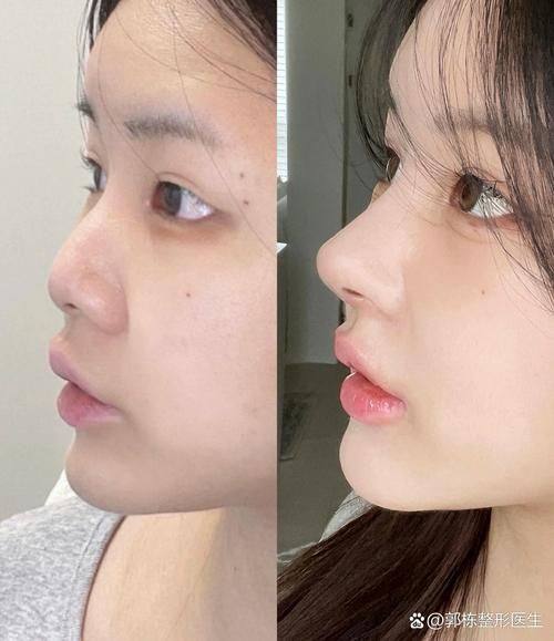 Santiphap医生口碑评价: