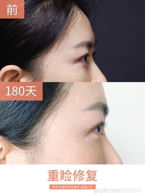 邵阳新术医疗美容门诊部价格表：