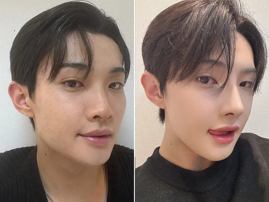 五、如果坚持选药水点痣，该怎么做才能降低风险