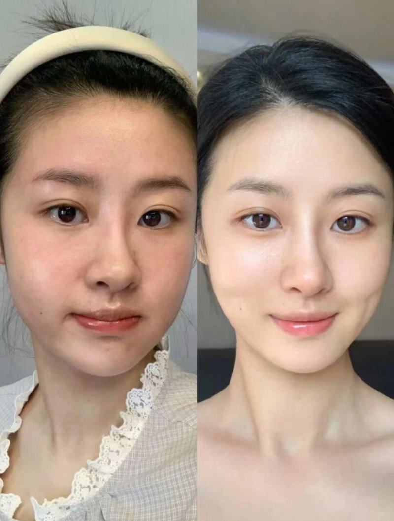 三、“成效好”的点痣药水，风险也更高