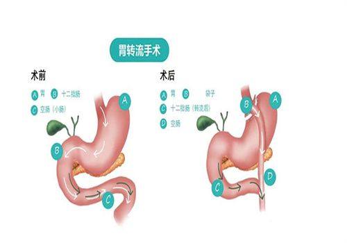 三、病理性隐患:不可忽视的身体信号