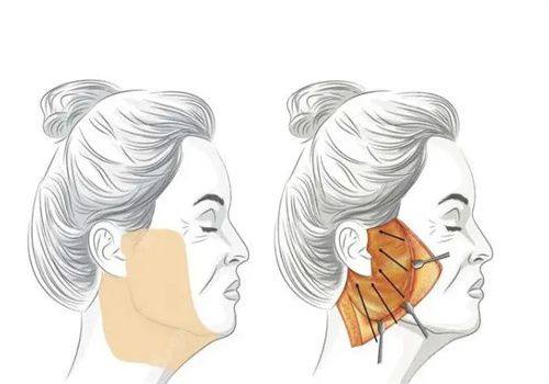 蔡振勇医生擅长领域