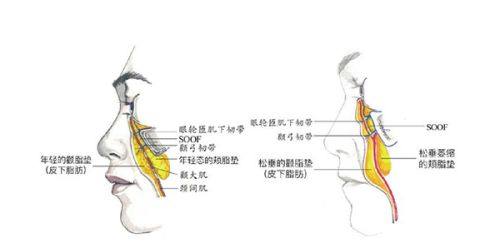 四、真实实例参考：烧伤疤痕修复的实际成效