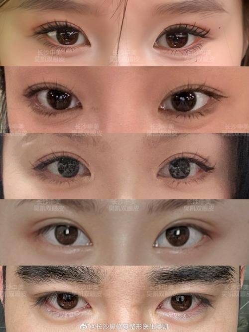 绍兴上虞亚韩整形医院价格表：