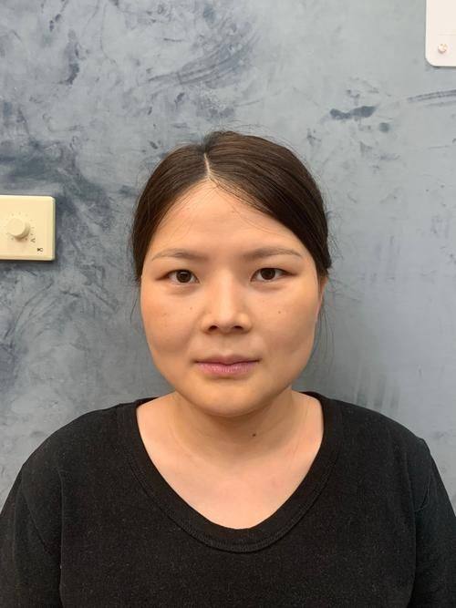 成都美立方(原华博)医疗美容医院价格表: