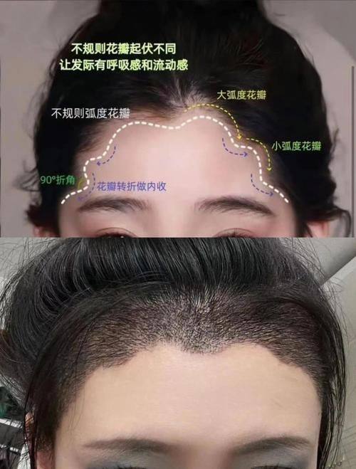 武汉洪山真程植发医院价格表