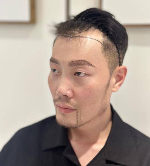 纳帕科伦医生技术优势