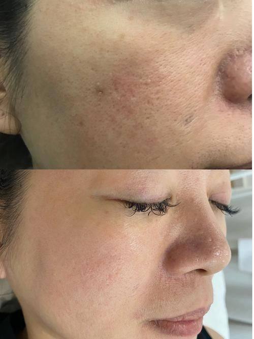 广州德医医疗美容诊所擅长项目