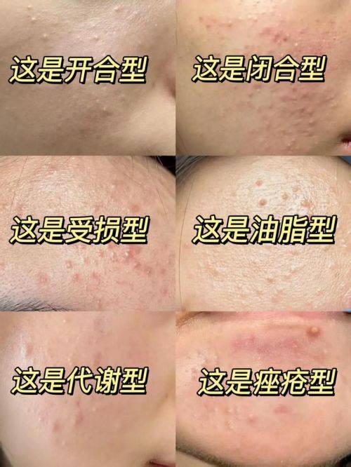 长崎Maria诊所价格表