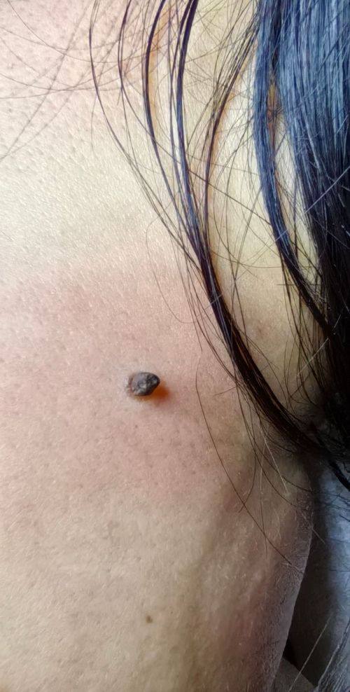 Wichuda医生擅长领域：