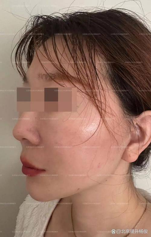 无锡丽都整形美容医院(原无锡瑞丽整形美容医院)价格表: