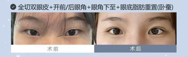 绍兴上虞亚韩整形医院预约挂号方式：