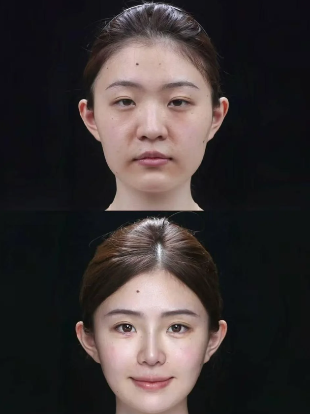 黔南州中医院美容整形科价格表: